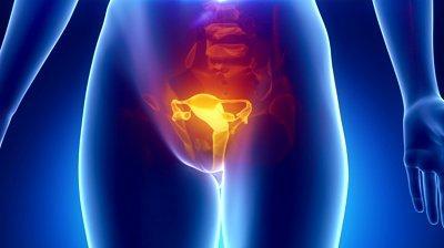 Do I have CHLAMYDIA?